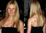 BG_celebrity-cupping-6.jpg