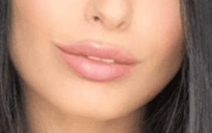 Wiki JuliaEF 117883 denti 1.png