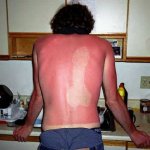 102_1649-alt-blog-sun.jpg